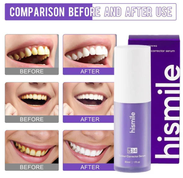 HiSmile V34 Teeth Whitener